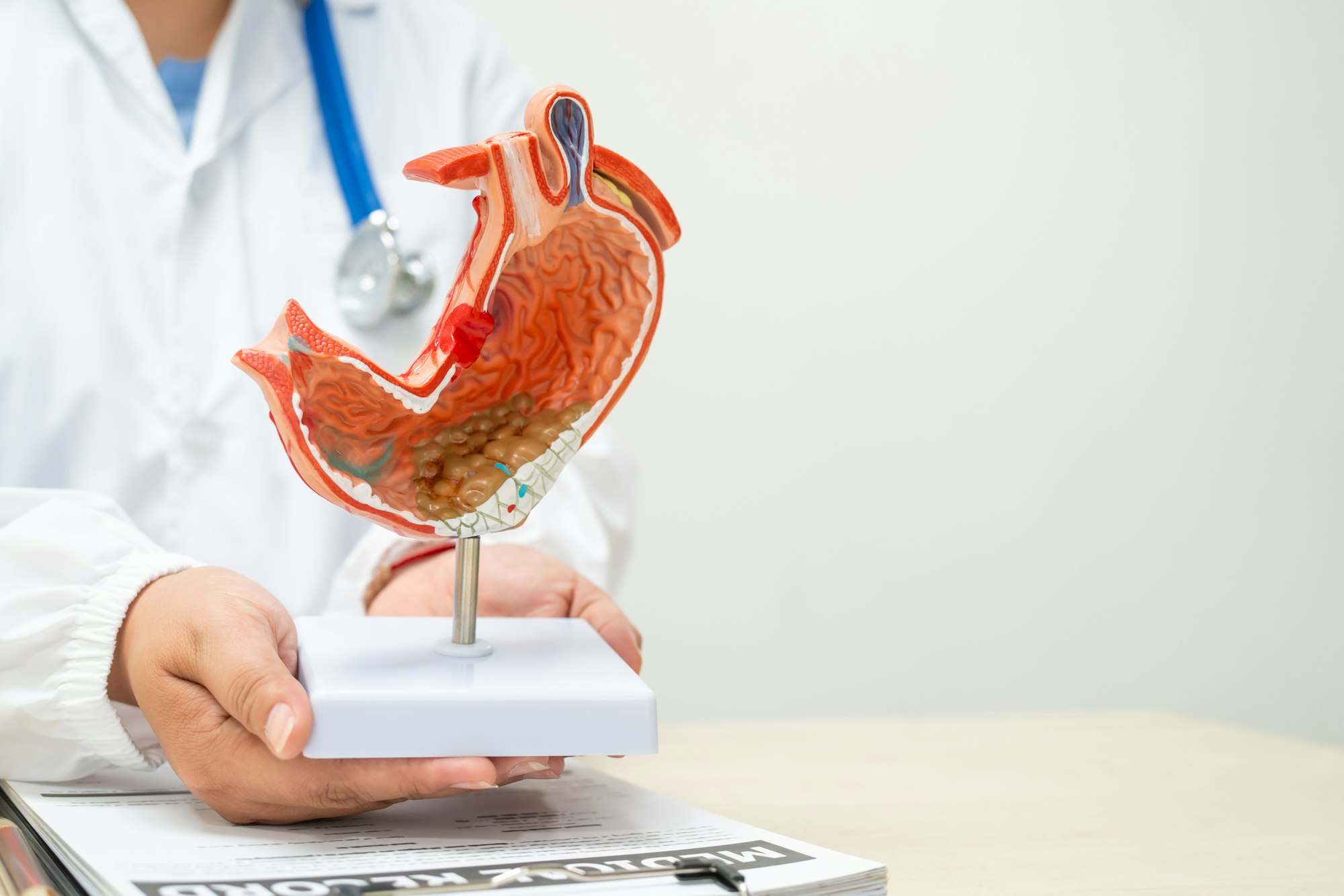 A female doctor a hospital desk discussing digestive disorders such as stomach ulcers,acid reflux