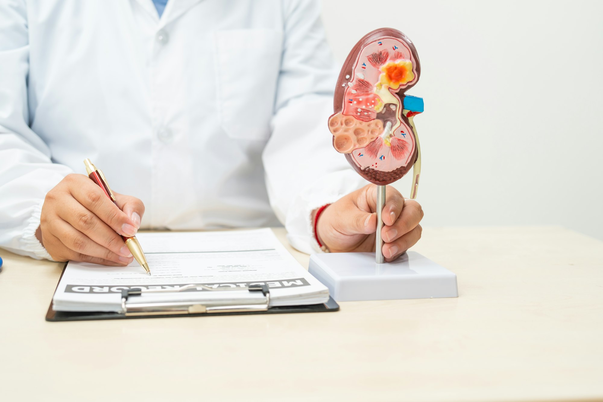 A female doctor works at a desk in hospital,discussing kidney failure and chronic kidney disease.