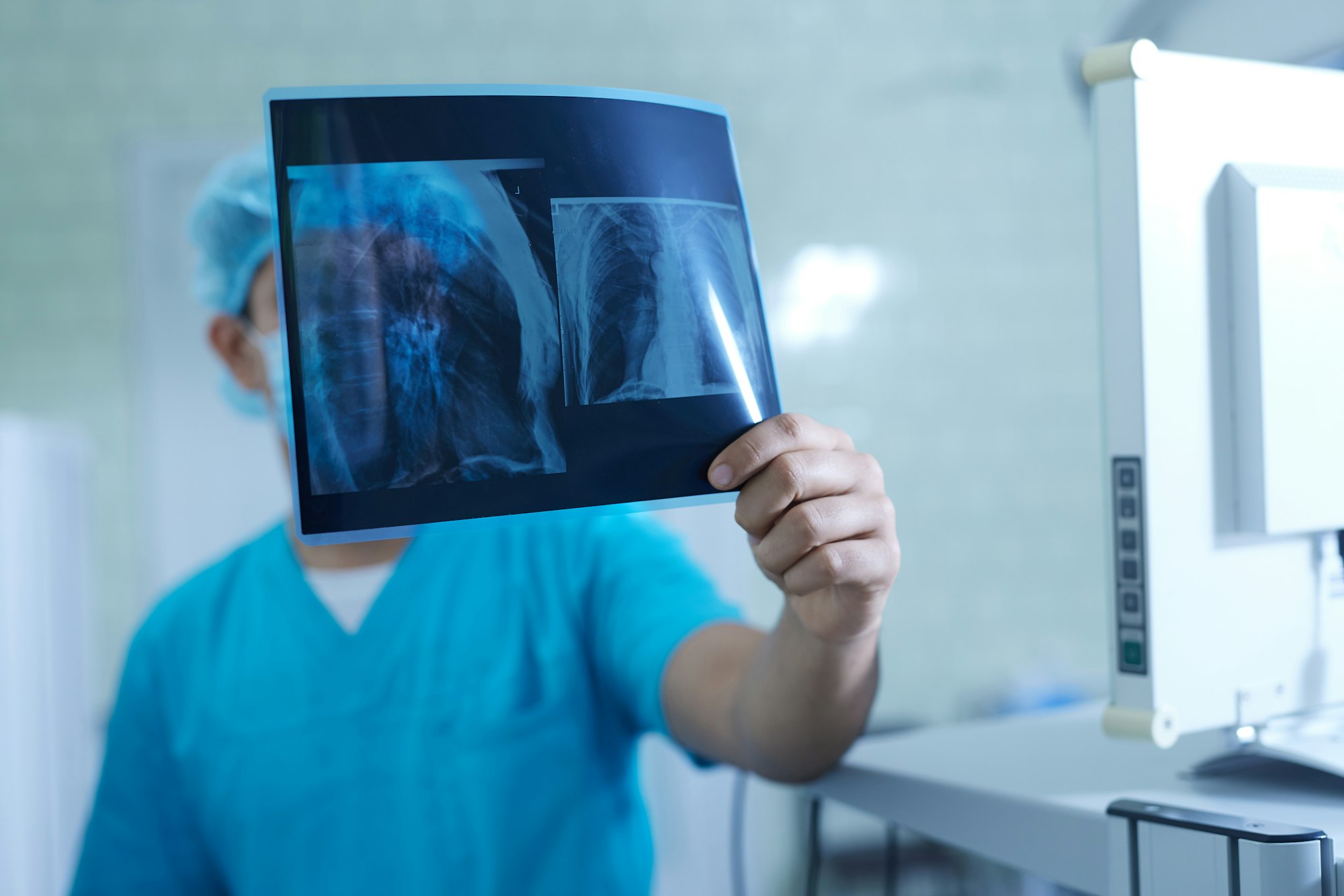 doctor holding x-ray result close up, ultrasonic ultrasound machine, selective focus