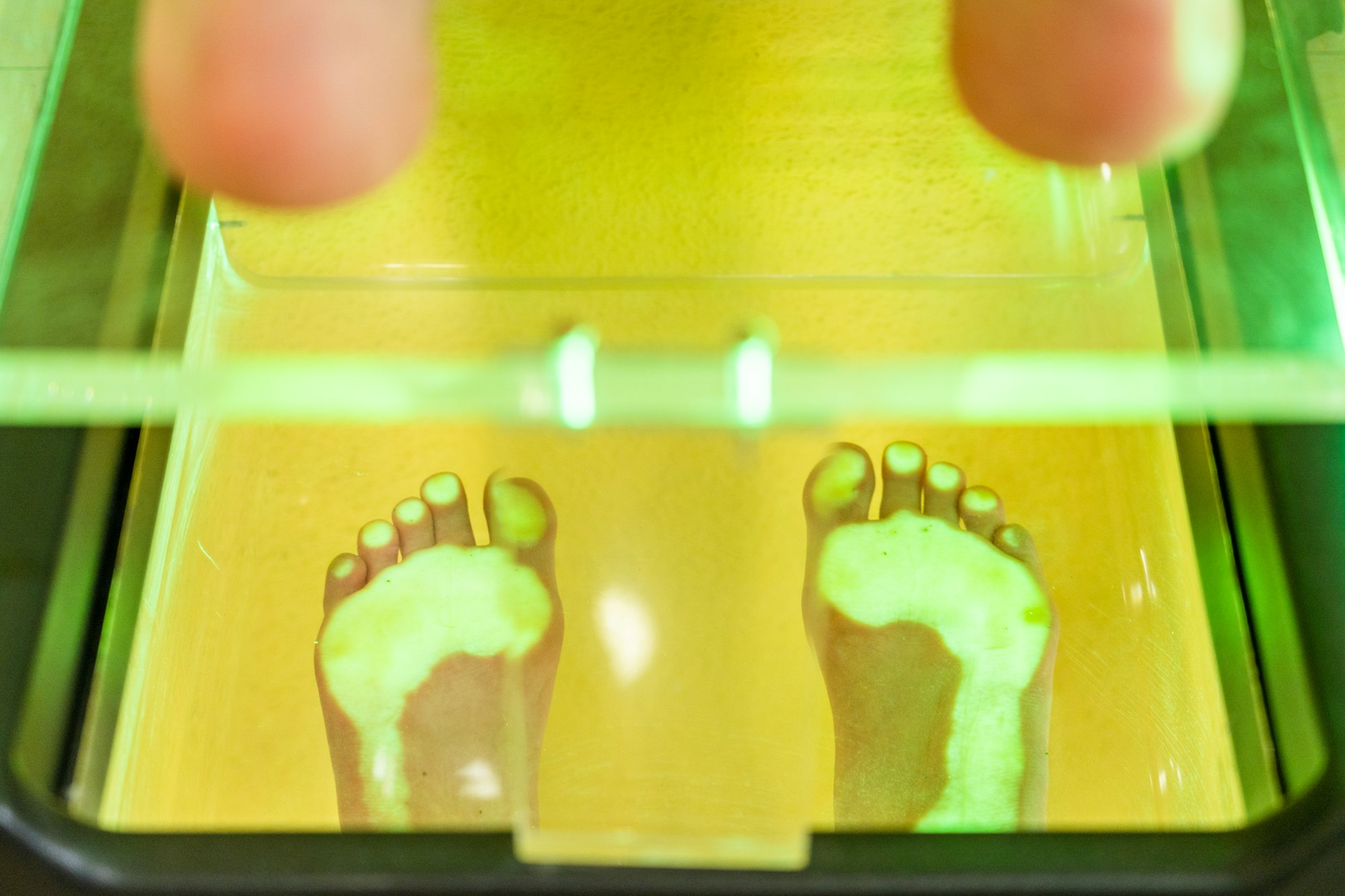 Female patient on a foot scanner in a podiatry clinic